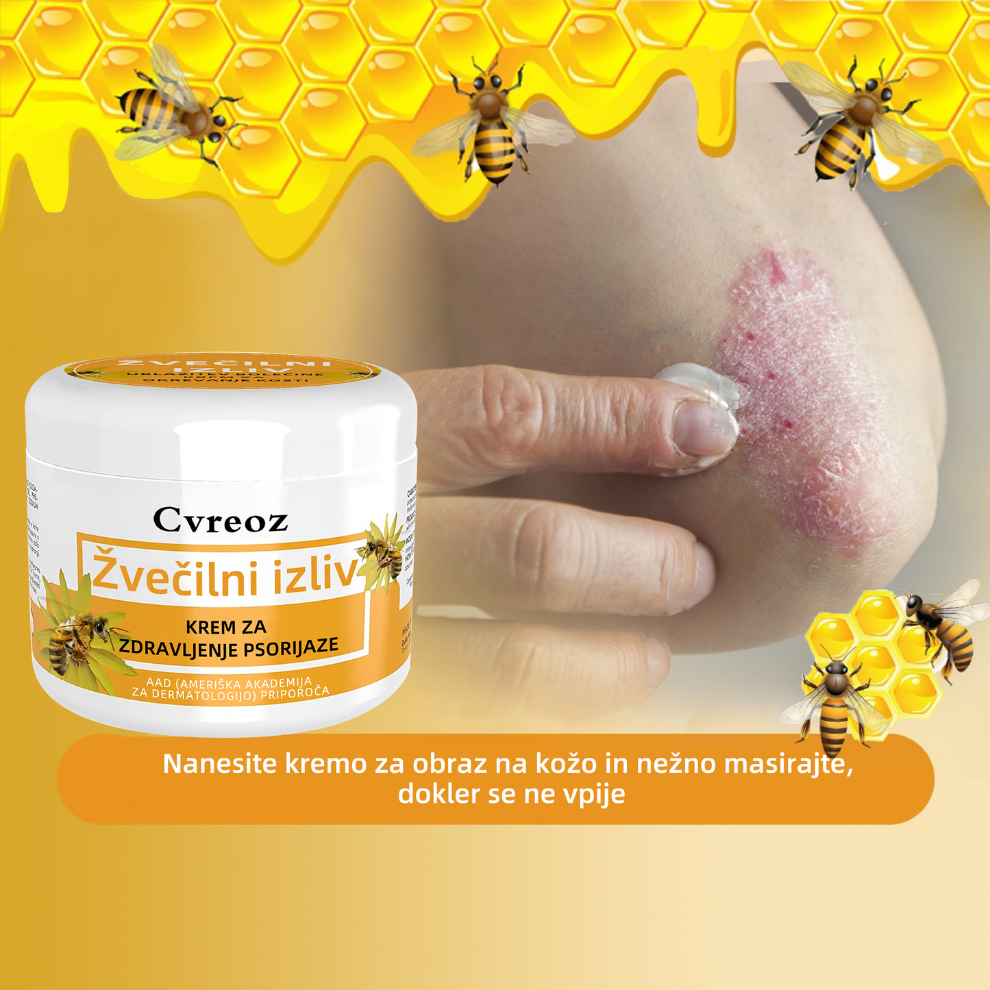 🌈Cvreoz krem za zdravljenje psorijaza z medonosjem (👨⚕Priporoča AAD)🐝🐝
