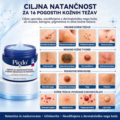 𝐏𝐢𝐜𝐝𝐨®🧑‍⚕️ 𝟕-𝐝𝐧𝐞𝐯𝐧𝐚 𝐤𝐫𝐞𝐦𝐚 𝐩𝐫𝐨𝐭𝐢 𝐤𝐨ž𝐧𝐢𝐦 𝐢𝐳𝐫𝐚𝐬𝐭𝐤𝐨𝐦 & 𝐩𝐢𝐠𝐦𝐞𝐧𝐭𝐧𝐢𝐦 𝐥𝐢𝐬𝐭𝐚𝐦𝐢 (Brezbolestna formula – brez brazgotin)🎋4️⃣