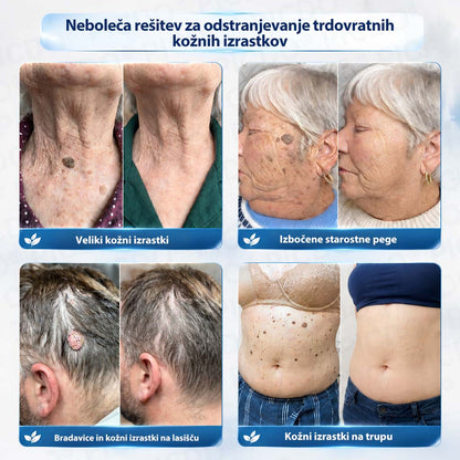 𝐏𝐢𝐜𝐝𝐨®🧑‍⚕️ 𝟕-𝐝𝐧𝐞𝐯𝐧𝐚 𝐤𝐫𝐞𝐦𝐚 𝐩𝐫𝐨𝐭𝐢 𝐤𝐨ž𝐧𝐢𝐦 𝐢𝐳𝐫𝐚𝐬𝐭𝐤𝐨𝐦 & 𝐩𝐢𝐠𝐦𝐞𝐧𝐭𝐧𝐢𝐦 𝐥𝐢𝐬𝐭𝐚𝐦𝐢 (Brezbolestna formula – brez brazgotin)🎋4️⃣