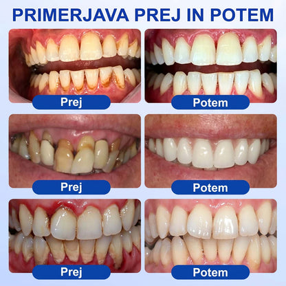 🦷 Evolvion® GumRevive gel za obnovo parodontalnega tkiva🍓3️⃣