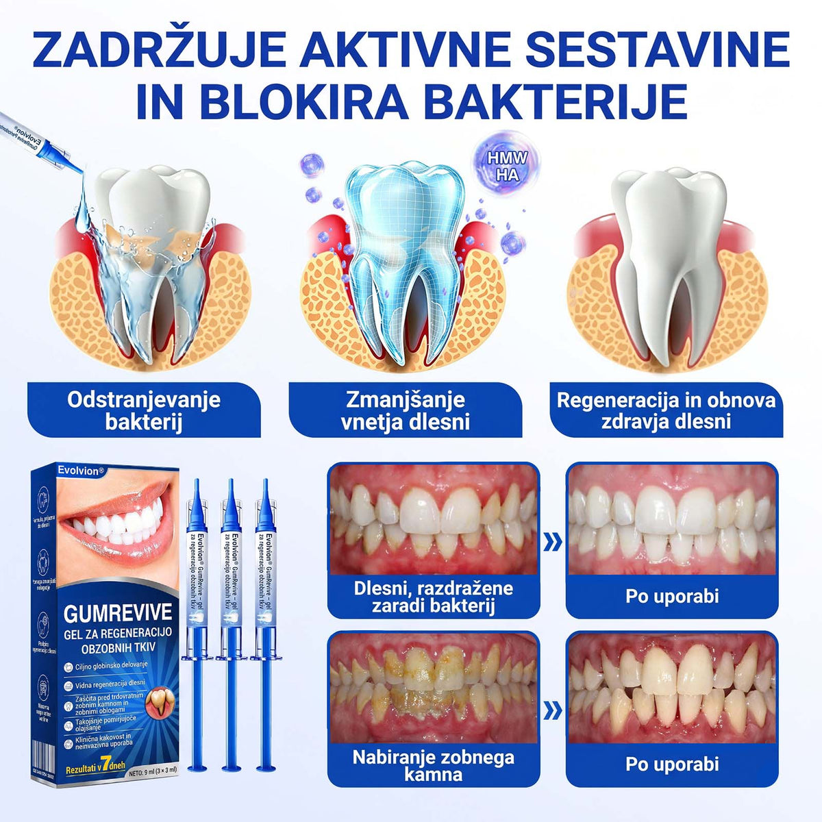 🦷 Evolvion® GumRevive gel za obnovo parodontalnega tkiva🍓3️⃣