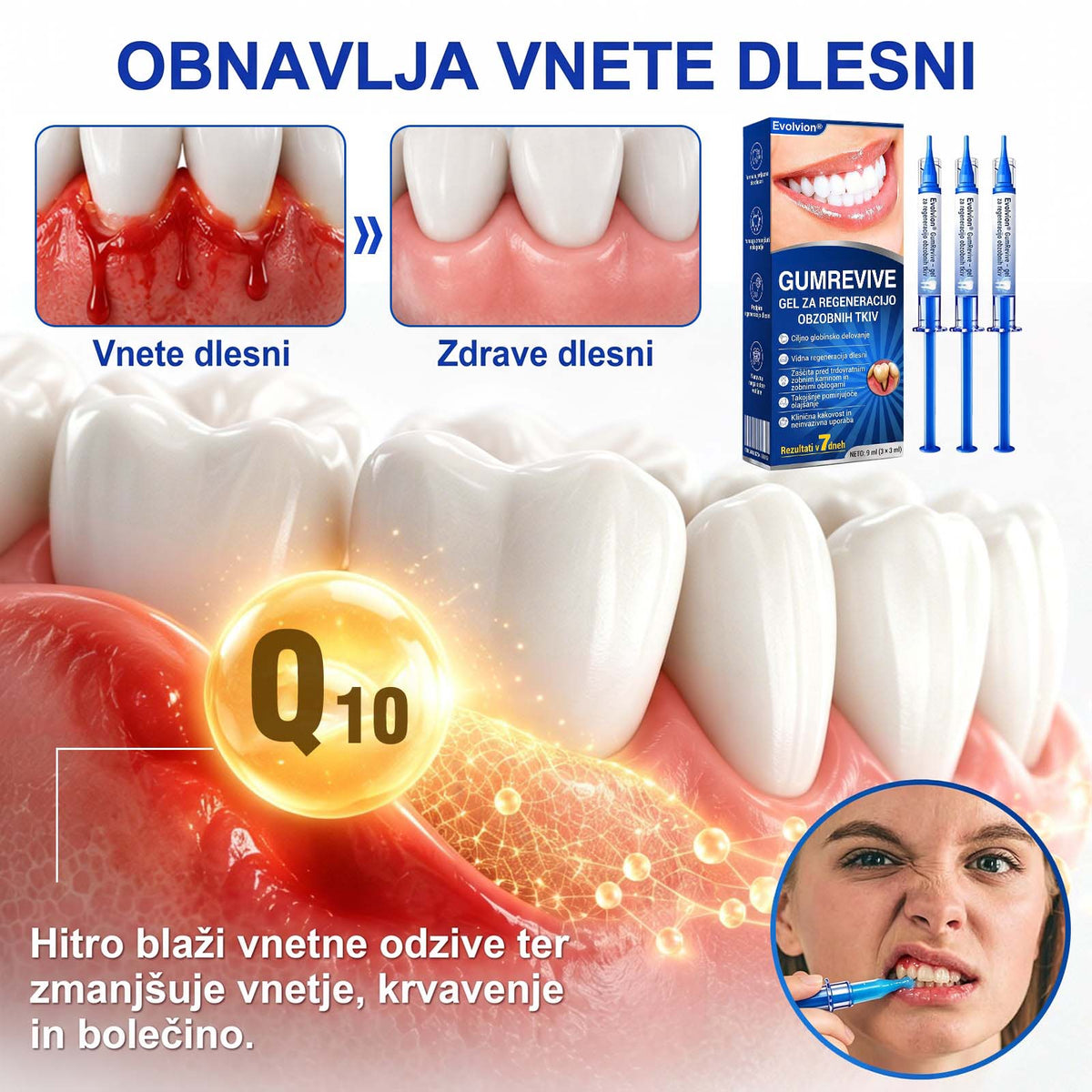 🦷 Evolvion® GumRevive gel za obnovo parodontalnega tkiva🍓3️⃣