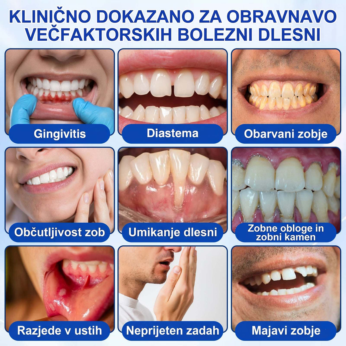 🦷 Evolvion® GumRevive gel za obnovo parodontalnega tkiva🍓3️⃣