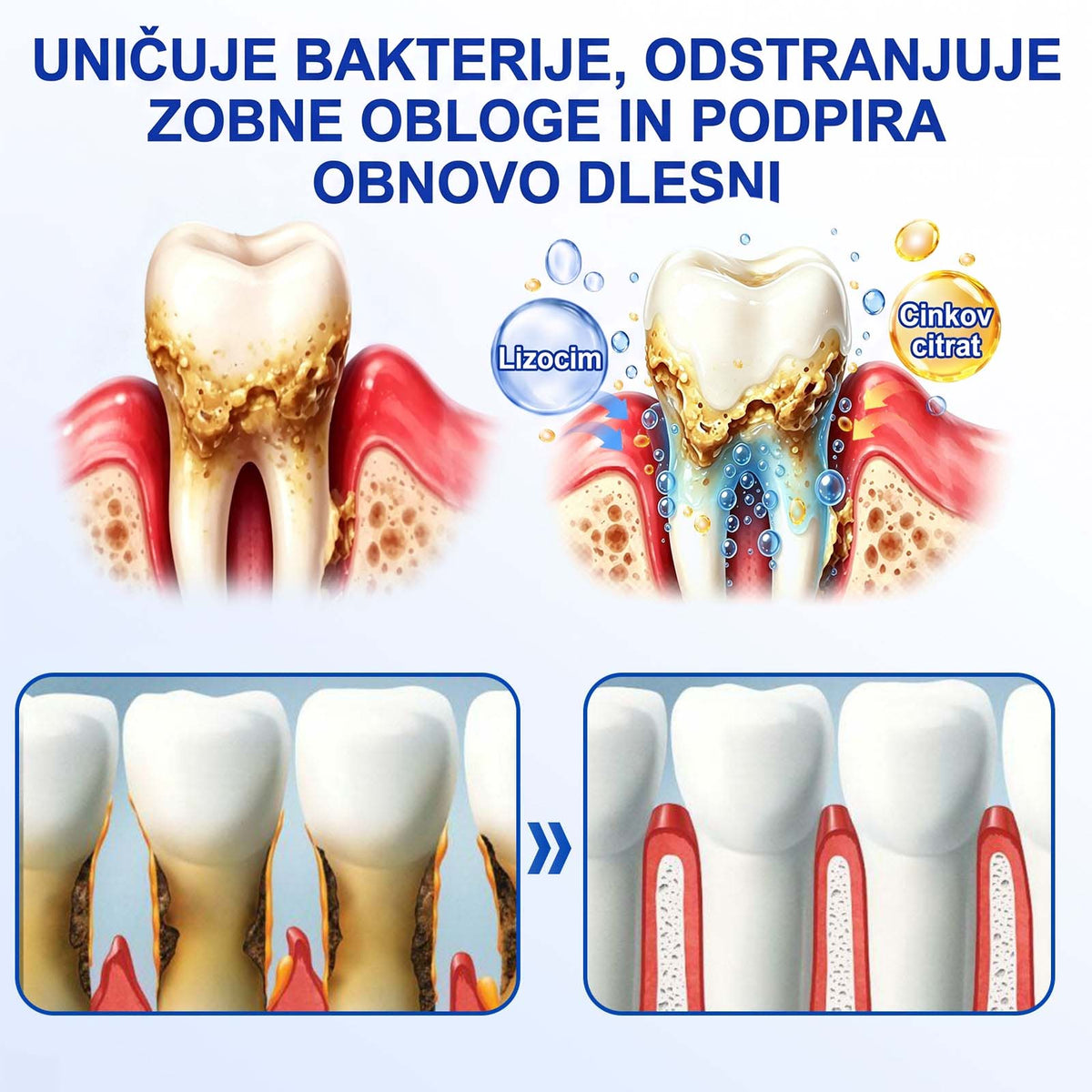 🦷 Evolvion® GumRevive gel za obnovo parodontalnega tkiva🍓3️⃣