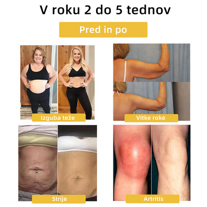 Zadnjih nekaj dni prodaje, izključno 20% off🎁 - 𝐶𝑍𝑇𝐼𝐼𝐶𝐿𝐸™ Terapevtski magnetni limfni obroč z mačjim očesom🔥🌸
