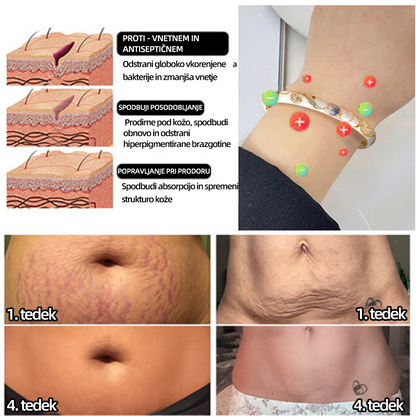 CZTICLE™ ZAPIRALNO Emaljirano 👩‍⚕️ Limfna Magnetna Terapija Zlata Zapestnica❤️‍🔥