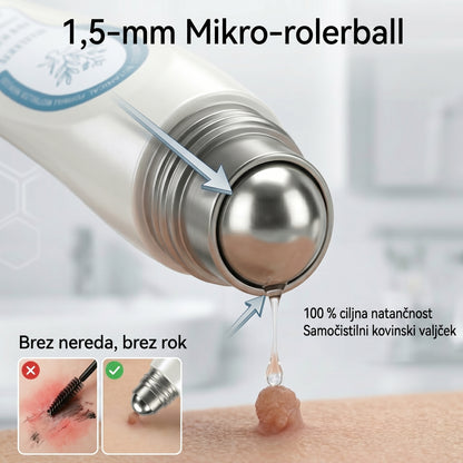 Uradna trgovina | ✅👩‍⚕️ 𝐏i𝐜𝐝o® 7-dnevni 𝗧𝗮𝗴 & 𝗦𝗽𝗼𝘁 𝐄𝐫𝐚𝘀𝐞𝐫 (Brez bolečin, brez brazgotin – valjčni aplikator) 🎉
