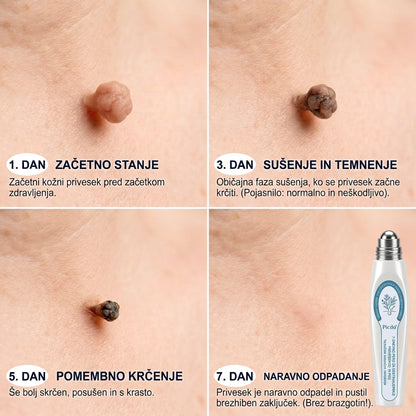 ✅️👩‍⚕️𝐏𝐢𝐜𝐝𝐨® 𝟕-𝐝𝐧𝐞𝐯𝐧𝐢 𝐨𝐝𝐬𝐭𝐫𝐚𝐧𝐣𝐞𝐯𝐚𝐥𝐞𝐜 𝐤𝐨ž𝐧𝐢𝐡 𝐢𝐳𝐫𝐚𝐬𝐭𝐤𝐨𝐯 𝐢𝐧 𝐦𝐚𝐝𝐞ž𝐞𝐯 (𝐫𝐨𝐥𝐥-𝐨𝐧 𝐚𝐩𝐥𝐢𝐤𝐚𝐭𝐨𝐫: 𝐛𝐫𝐞𝐳 𝐛𝐨𝐥𝐞č𝐢𝐧 𝐢𝐧 𝐛𝐫𝐚𝐳𝐠𝐨𝐭𝐢𝐧)💟
