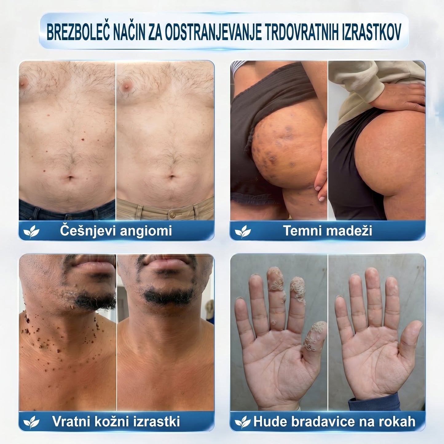 ✅️👩‍⚕️𝐏𝐢𝐜𝐝𝐨® 𝟕-𝐝𝐧𝐞𝐯𝐧𝐢 𝐨𝐝𝐬𝐭𝐫𝐚𝐧𝐣𝐞𝐯𝐚𝐥𝐞𝐜 𝐤𝐨ž𝐧𝐢𝐡 𝐢𝐳𝐫𝐚𝐬𝐭𝐤𝐨𝐯 𝐢𝐧 𝐦𝐚𝐝𝐞ž𝐞𝐯 (𝐫𝐨𝐥𝐥-𝐨𝐧 𝐚𝐩𝐥𝐢𝐤𝐚𝐭𝐨𝐫: 𝐛𝐫𝐞𝐳 𝐛𝐨𝐥𝐞č𝐢𝐧 𝐢𝐧 𝐛𝐫𝐚𝐳𝐠𝐨𝐭𝐢𝐧)💟