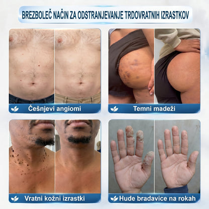 ✅️👩‍⚕️𝐏𝐢𝐜𝐝𝐨® 𝟕-𝐝𝐧𝐞𝐯𝐧𝐢 𝐨𝐝𝐬𝐭𝐫𝐚𝐧𝐣𝐞𝐯𝐚𝐥𝐞𝐜 𝐤𝐨ž𝐧𝐢𝐡 𝐢𝐳𝐫𝐚𝐬𝐭𝐤𝐨𝐯 𝐢𝐧 𝐦𝐚𝐝𝐞ž𝐞𝐯 (𝐫𝐨𝐥𝐥-𝐨𝐧 𝐚𝐩𝐥𝐢𝐤𝐚𝐭𝐨𝐫: 𝐛𝐫𝐞𝐳 𝐛𝐨𝐥𝐞č𝐢𝐧 𝐢𝐧 𝐛𝐫𝐚𝐳𝐠𝐨𝐭𝐢𝐧)💟