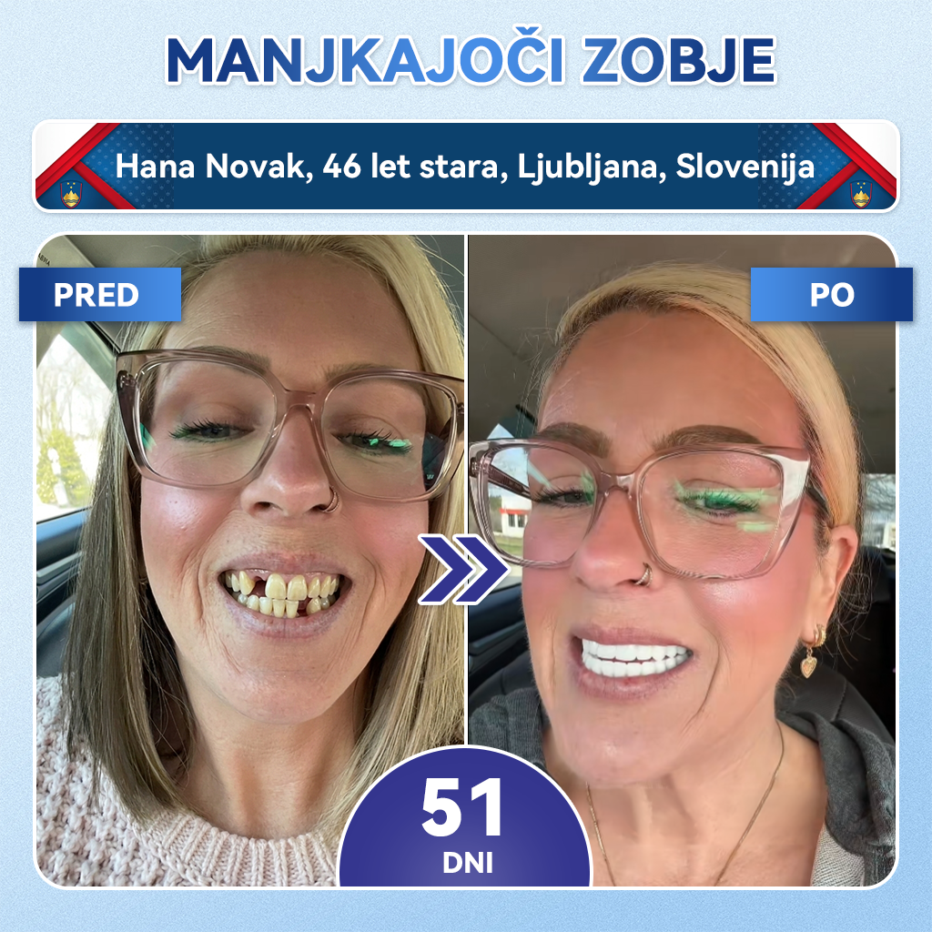 𝐺𝑙𝑖𝑚𝑚𝑒𝑟𝑙𝑦® 𝑇𝑖𝑑𝑒𝑔𝑙𝑢𝑠𝑖𝑏 𝑚𝑖𝑘𝑟𝑜𝑛𝑒𝑒𝑑𝑙𝑛𝑖 𝑜𝑏𝑙𝑖ž𝑖 𝑧𝑎 𝑜𝑏𝑛𝑜𝑣𝑜 𝑧𝑜𝑏 𝑖𝑛 𝑑𝑙𝑒𝑠𝑛𝑖 (🦷 𝑶𝒃𝒏𝒐𝒗𝒂 𝒛𝒐𝒃𝒏𝒆 𝒔𝒌𝒍𝒆𝒏𝒊𝒏𝒆 𝒊𝒏 𝒅𝒆𝒏𝒕𝒊𝒏𝒂 • 𝑲𝒓𝒆𝒑𝒊𝒕𝒆𝒗 𝒅𝒍𝒆𝒔𝒏𝒊 • 𝑶𝒅𝒔𝒕𝒓𝒂𝒏𝒋𝒆𝒗𝒂𝒏𝒋𝒆 𝒛𝒐𝒃𝒏𝒊𝒉 𝒐𝒃𝒍𝒐𝒈 𝒊𝒏 𝒏𝒆𝒑𝒓𝒊𝒋𝒆𝒕𝒏𝒆𝒈𝒂 𝒛𝒂𝒅𝒂𝒉𝒂 • 𝑳𝒂𝒋š𝒂𝒏𝒋𝒆 𝒐𝒃č𝒖𝒕𝒍𝒋𝒊𝒗𝒐𝒔𝒕𝒊 𝒛𝒐𝒃)