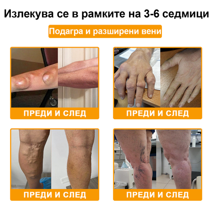ArthroFree™ Krema za lajšanje bolečin v kosteh s čebeljim strupom (Posebej za starejše, priporočena s strani Ameriške akademije ortopedske kirurgije - AAOS)❤️‍🔥