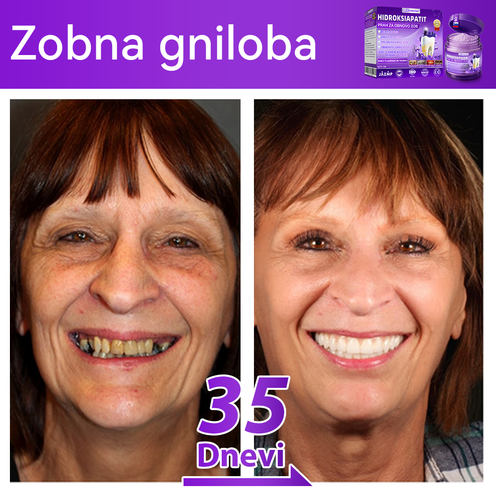 Uradna trgovina |𝑫𝒐𝒓𝒎𝒐𝒓𝒏𝒂® Prašek za obnovo zob z hidroksiapatitom✅Učinkovito obnavlja karies, težave z dlesnimi, občutljivost zob, razjede v ustih in rumenenje zob, hkrati pa znatno izboljšuje splošno zdravje ustne votline🧑‍⚕️