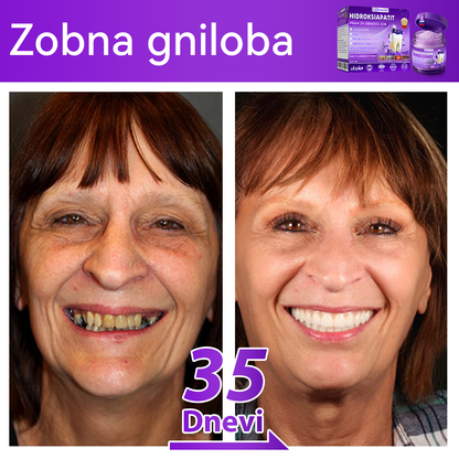 Uradna trgovina |𝑫𝒐𝒓𝒎𝒐𝒓𝒏𝒂® Prašek za obnovo zob z hidroksiapatitom✅Učinkovito obnavlja karies, težave z dlesnimi, občutljivost zob, razjede v ustih in rumenenje zob, hkrati pa znatno izboljšuje splošno zdravje ustne votline🧑‍⚕️