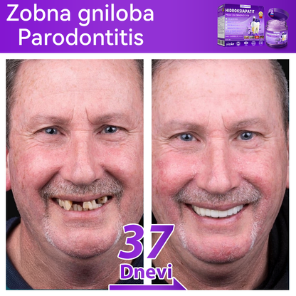 Uradna trgovina |𝑫𝒐𝒓𝒎𝒐𝒓𝒏𝒂® Prašek za obnovo zob z hidroksiapatitom✅Učinkovito obnavlja karies, težave z dlesnimi, občutljivost zob, razjede v ustih in rumenenje zob, hkrati pa znatno izboljšuje splošno zdravje ustne votline🧑‍⚕️