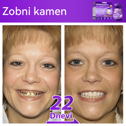Uradna trgovina |𝑫𝒐𝒓𝒎𝒐𝒓𝒏𝒂® Prašek za obnovo zob z hidroksiapatitom✅Učinkovito obnavlja karies, težave z dlesnimi, občutljivost zob, razjede v ustih in rumenenje zob, hkrati pa znatno izboljšuje splošno zdravje ustne votline🧑‍⚕️